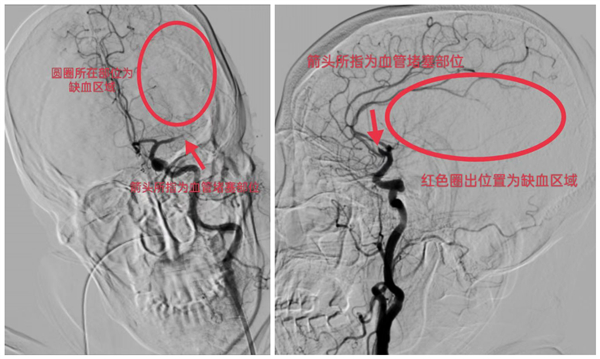 圖片 12 術前.jpg